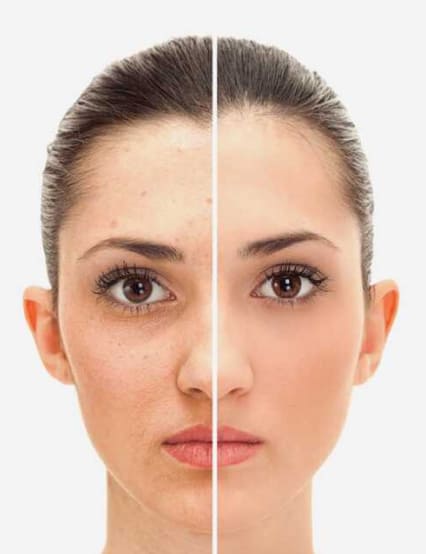 https://phoenixcosmeticcentre.com/public/facelift-anti-aging-